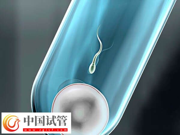 什么会影响试管婴儿成功率(图2) 什么会影响试管婴儿成功率(图2)