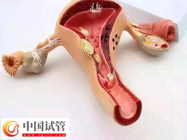 什么会影响试管婴儿成功率(图1) 什么会影响试管婴儿成功率(图1)