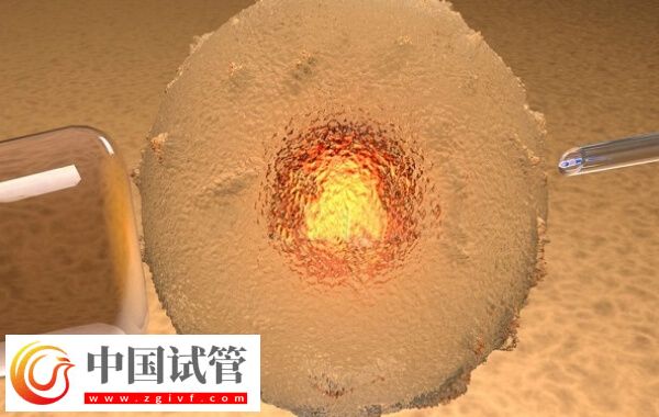 三代试管PGD技术检测是否必须养囊(图2) 三代试管PGD技术检测是否必须养囊(图2)