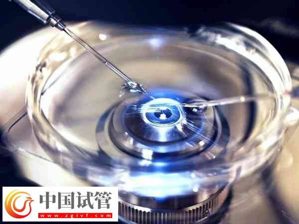 取卵后一个月卵巢是否恢复了(图2) 取卵后一个月卵巢是否恢复了(图2)