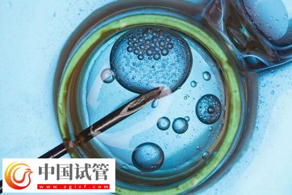 做试管对amh值有没有要求(图1) 做试管对amh值有没有要求(图1)