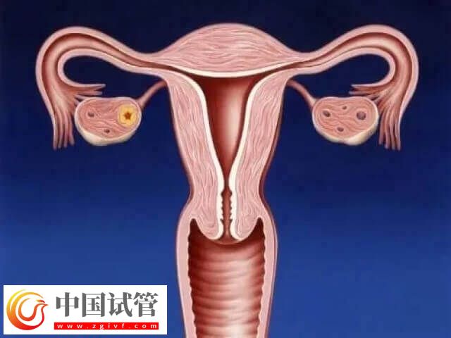 amh低做试管成功可能性大不大(图1) amh低做试管成功可能性大不大(图1)