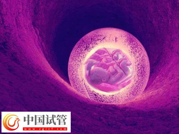 子宫憩室影不影响试管移植(图2) 子宫憩室影不影响试管移植(图2)