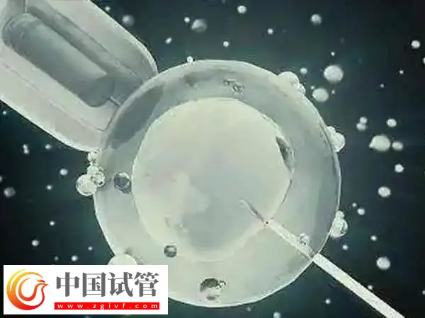 3bc的冻囊胚质量好不好(图1) 3bc的冻囊胚质量好不好(图1)