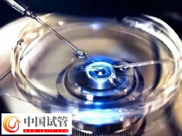 3bc的冻囊胚质量好不好(图2) 3bc的冻囊胚质量好不好(图2)