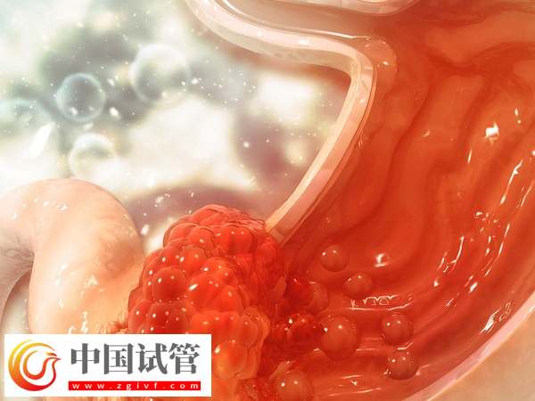 做试管吃芬必得的作用和功效(图2) 做试管吃芬必得的作用和功效(图2)