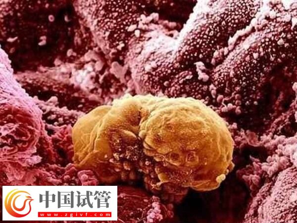 卵巢早衰amh值0.08试管能不能成功(图1) 卵巢早衰amh值0.08试管能不能成功(图1)