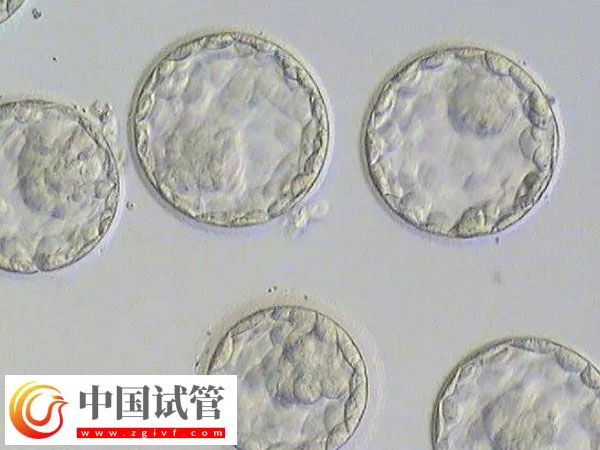 移植囊胚和三天胚胎是否一样(图1) 移植囊胚和三天胚胎是否一样(图1)