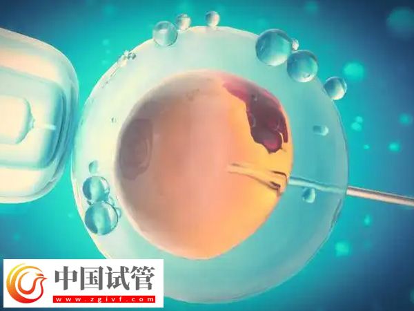 身高153做试管能不能要双胞胎(图1) 身高153做试管能不能要双胞胎(图1)