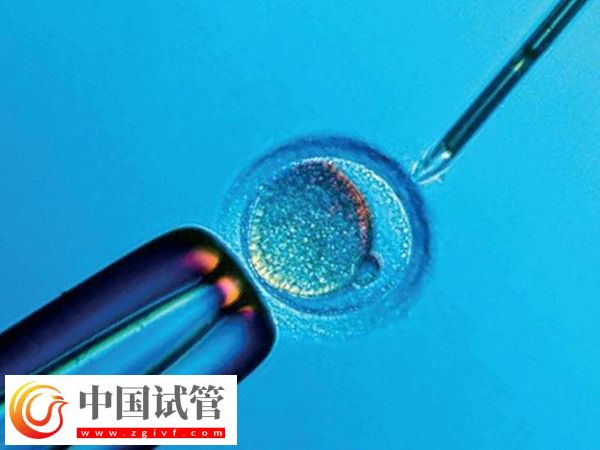 身高153做试管能不能要双胞胎(图2) 身高153做试管能不能要双胞胎(图2)