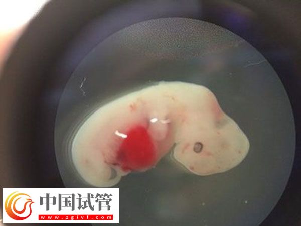 如何解读胚胎筛查结果报告单(图1) 如何解读胚胎筛查结果报告单(图1)