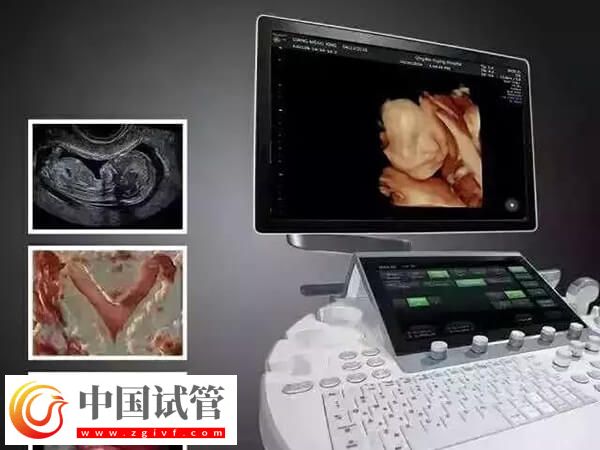 鹰潭公立三甲医院做一次四维彩超多少钱?(图1) 鹰潭公立三甲医院做一次四维彩超多少钱?(图1)
