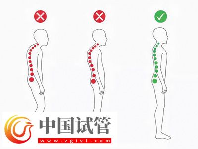 不良体态正悄悄损害你的健康(图1) 不良体态正悄悄损害你的健康(图1)