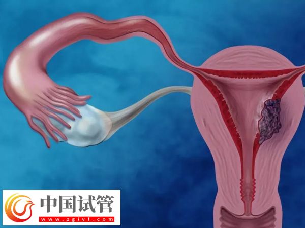 攀枝花试管医院哪家好(图2) 攀枝花试管医院哪家好(图2)