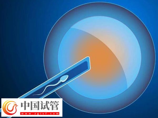 攀枝花试管医院哪家好(图1) 攀枝花试管医院哪家好(图1)