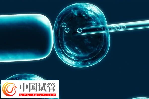 试管移植反复不着床需要查什么(图1) 试管移植反复不着床需要查什么(图1)