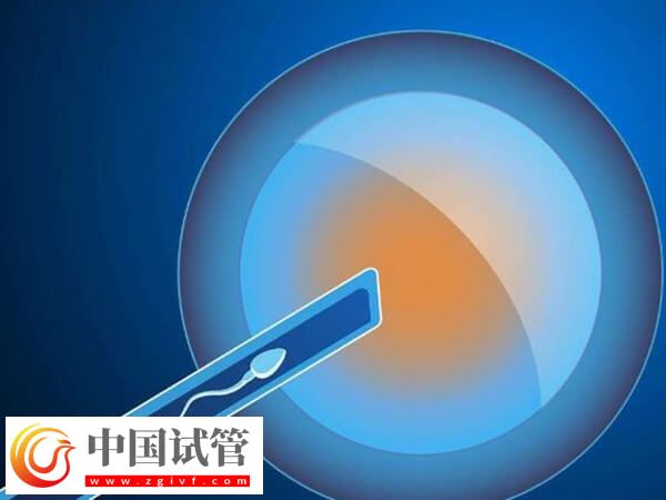 北华大学附属医院试管婴儿是第几代技术?(图1) 北华大学附属医院试管婴儿是第几代技术?(图1)
