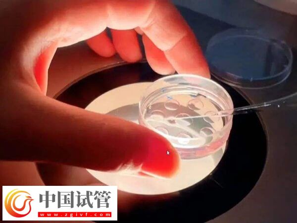 试管可不可以移植两个胚胎？(图3)