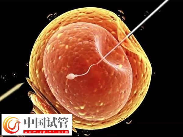 松原能做一代试管的三甲医院是哪家?(图1) 松原能做一代试管的三甲医院是哪家?(图1)