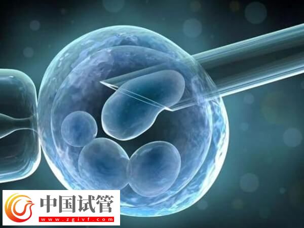 怀孕六周验血胎儿鉴定准吗?需要预约吗?(图1) 怀孕六周验血胎儿鉴定准吗?需要预约吗?(图1)