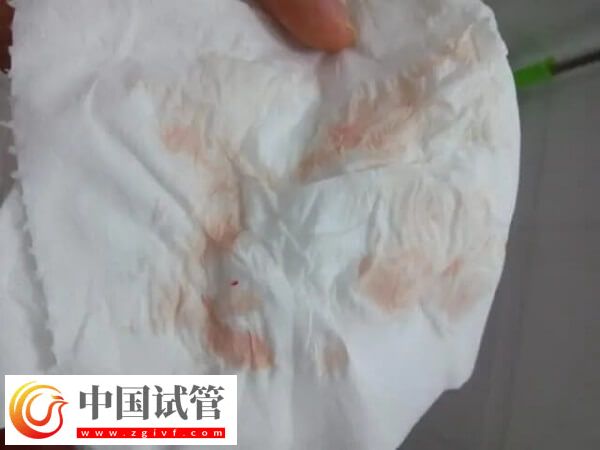 胚胎移植后大便不成形怎么回事(图2) 胚胎移植后大便不成形怎么回事(图2)
