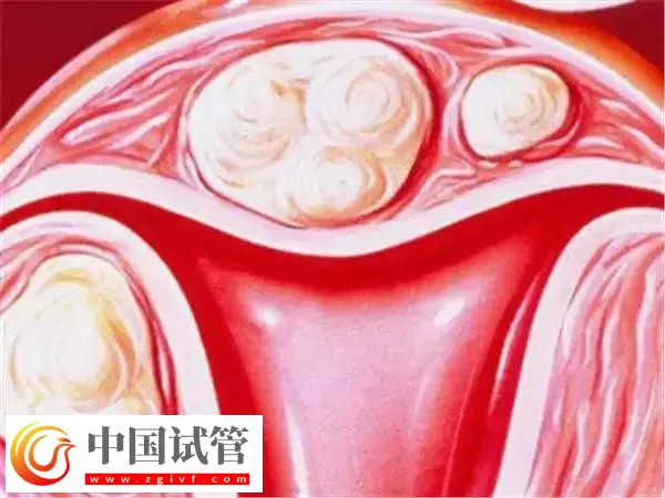 为什么医生不给移植鲜胚(图2) 为什么医生不给移植鲜胚(图2)