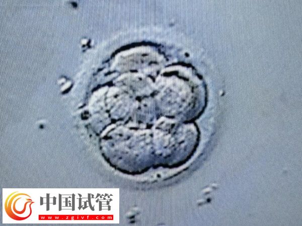 试管一次不成功二次移植费用多少(图2) 试管一次不成功二次移植费用多少(图2)