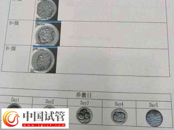 囊胚和冻囊胚是否一样(图1) 囊胚和冻囊胚是否一样(图1)