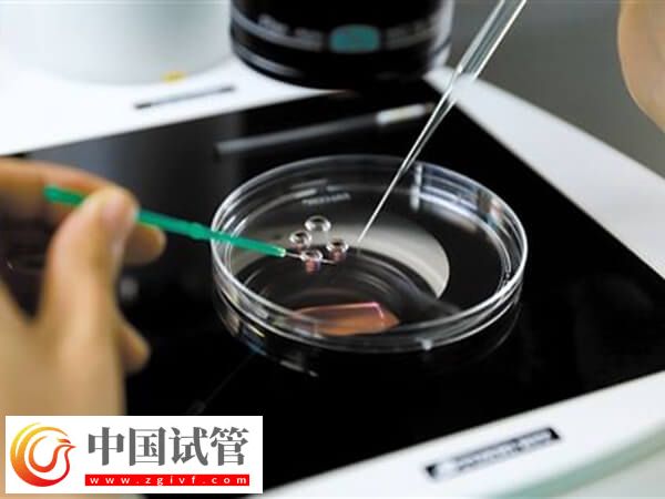 精子活力低做试管怎么办(图2) 精子活力低做试管怎么办(图2)