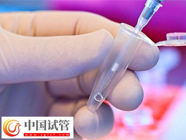 试管婴儿哪个步骤最疼(图3) 试管婴儿哪个步骤最疼(图3)