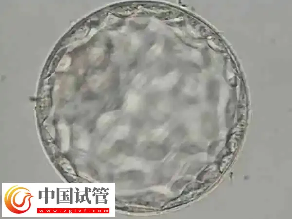 怎么判断试管移植成功与否(图1) 怎么判断试管移植成功与否(图1)