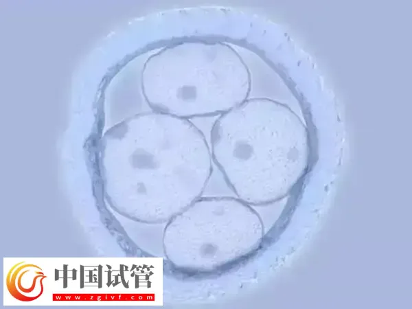 胚胎移植第11天肚子刺疼怎么回事(图1) 胚胎移植第11天肚子刺疼怎么回事(图1)