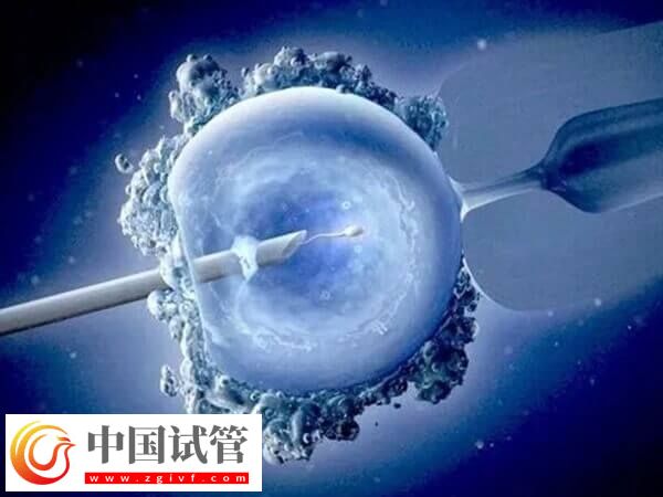 试管婴儿CET和FET是什么意思(图2) 试管婴儿CET和FET是什么意思(图2)