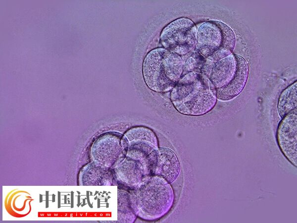 哪些人适合移植囊胚(图2) 哪些人适合移植囊胚(图2)