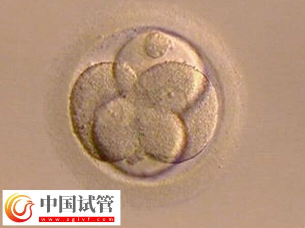试管婴儿移植前胚胎如何评分(图1) 试管婴儿移植前胚胎如何评分(图1)