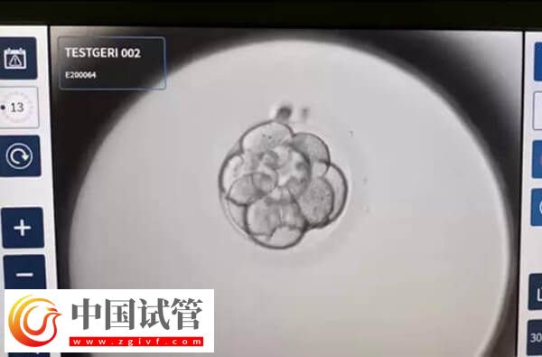 做二代试管为什么老配成c级胚胎(图1) 做二代试管为什么老配成c级胚胎(图1)