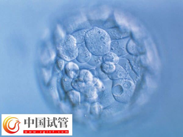 鲜胚和冻胚移植哪个好(图1) 鲜胚和冻胚移植哪个好(图1)