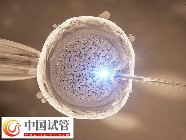 成都做试管婴儿哪家好(图3) 成都做试管婴儿哪家好(图3)