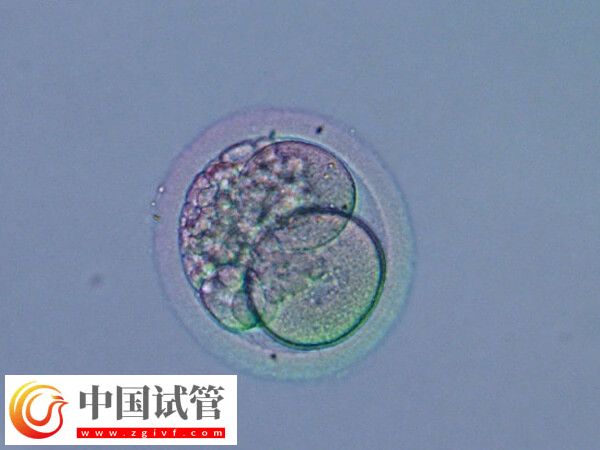 移植囊胚是不是容易生下双胞胎(图2) 移植囊胚是不是容易生下双胞胎(图2)