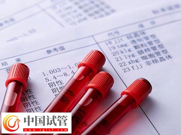 30岁促卵泡刺激素100多是怎么回事(图1) 30岁促卵泡刺激素100多是怎么回事(图1)