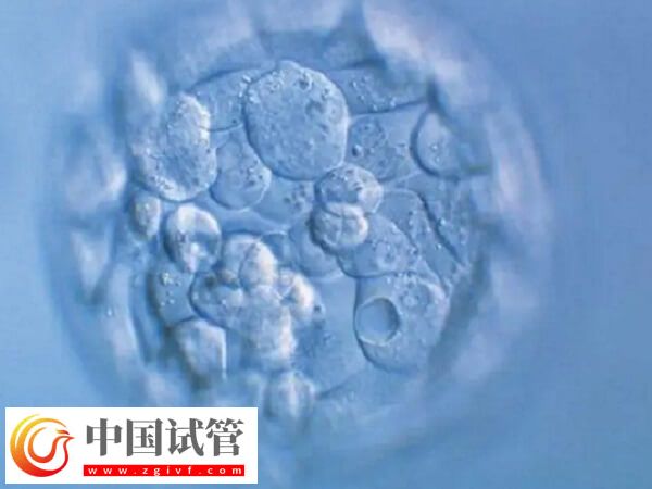 30岁促卵泡刺激素100多是怎么回事(图2) 30岁促卵泡刺激素100多是怎么回事(图2)