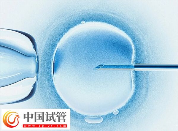 广州能生男孩的试管医院有哪些(图2) 广州能生男孩的试管医院有哪些(图2)