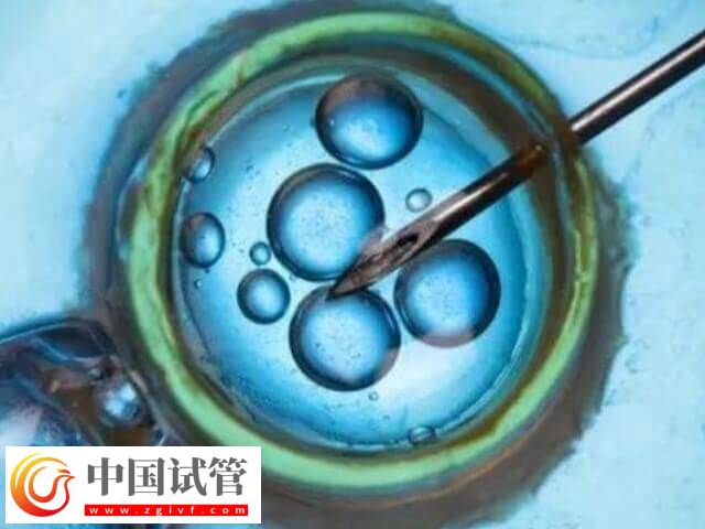 上海试管医院排名前十名(图1) 上海试管医院排名前十名(图1)
