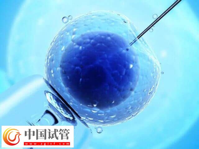 一代试管生男孩的经验是什么(图2) 一代试管生男孩的经验是什么(图2)