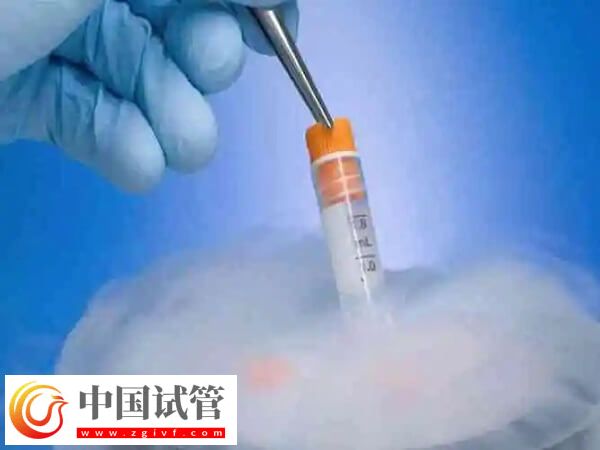 53岁高龄女性做试管婴儿(图2) 53岁高龄女性做试管婴儿(图2)