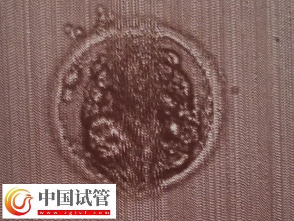 第7天囊胚4Bb有无必要移植(图1) 第7天囊胚4Bb有无必要移植(图1)