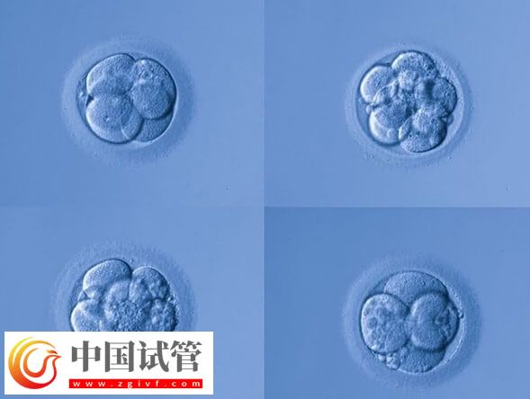 第三代试管婴儿移植6bc囊胚成功率多大(图2) 第三代试管婴儿移植6bc囊胚成功率多大(图2)