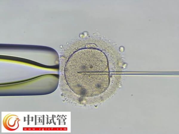 pgs筛查会淘汰多少囊胚(图1) pgs筛查会淘汰多少囊胚(图1)