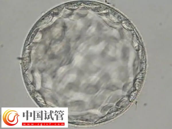 胚胎8细胞三级是不是比5细胞好(图2) 胚胎8细胞三级是不是比5细胞好(图2)