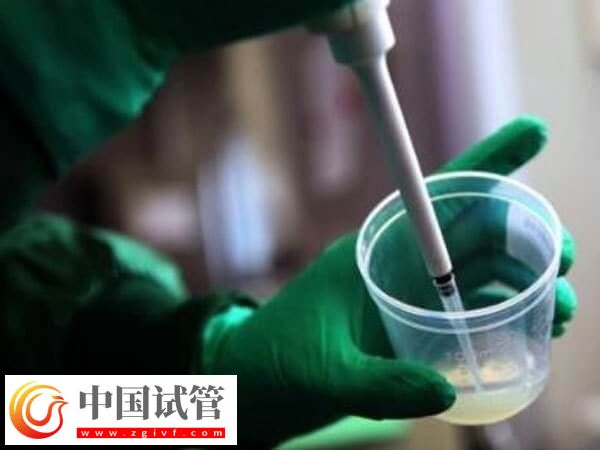 艾滋病洗精费用是多少(图2) 艾滋病洗精费用是多少(图2)